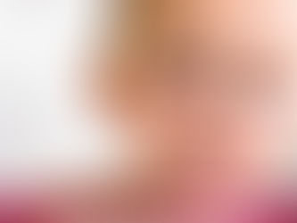 Conjunitivitis- Dra. Luz Rivera- Pediatra