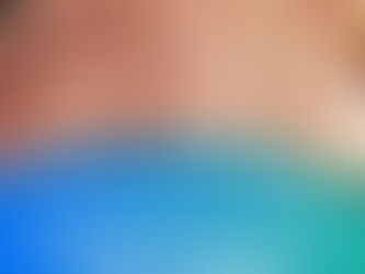 La Importancia De La Amputación Oportuna En Cáncer De Hueso|Dr. Franco Krakaur|Cirujano Oncólogo