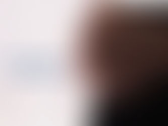 Embarazo Y Várices | ClÃnica De Enfermedades Vasculares