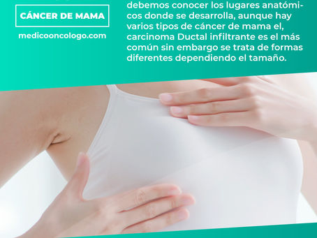 "Tipos De Cáncer De Mama"/ Dr. Franco Krakaur/ Cirujano OncólogoÂ