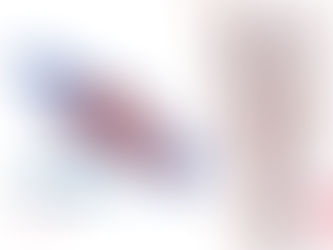 Flebitis | ClÃnica De Enfermedades Vasculares y Heridas