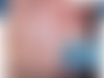 Inversión De Flujo Y Aumento De Presión En La Válvula | Clínica De Enfermedades Vasculares Y Heridas