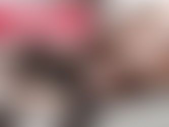 Tratamientos Conservadores Contra Las Várices | Clínica De Enfermedades Vasculares