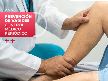 Prevención De Várices Control Médico Periódico| ClÃnica De Enfermedades Vasculares Y Heridas