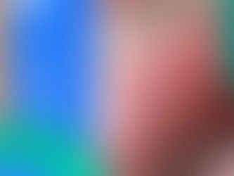 Cáncer De Lengua|Dr. Franco Krakaur | Cirujano Oncólogo