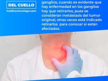 "Ganglios Del Cuello"/ Dr. Franco Krakaur/ Cirujano Oncólogo