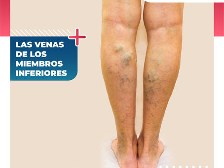 Las Venas De Los Miembros Inferiores |Clínica De Enfermedades Vasculares Y Heridas