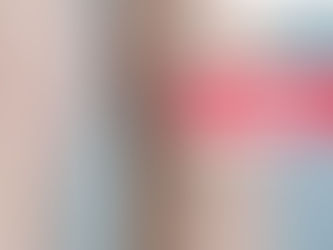 ¿Se Puede Tener Várices En Una Sola Pierna? | ClÃnica De Enfermedades Vasculares