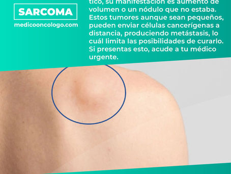 "Sarcoma"/ Dr. Franco Krakaur/ Cirujano OncólogoÂ
