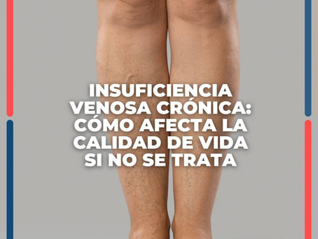 Insuficiencia Venosa Crónica: Cómo Afecta La Calidad De Vida Si No Se Trata | Clínica De Enfermedades Vasculares Y Heridas