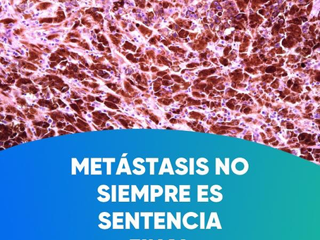 metástasis no siempre es una sentencia |Cirujano Oncólogo|Dr. Franco Krakaur.