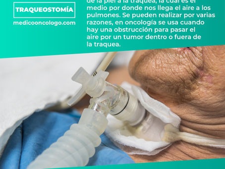 "TraqueostomÃa"/ Dr. Franco Krakaur/ Cirujano OncólogoÂ
