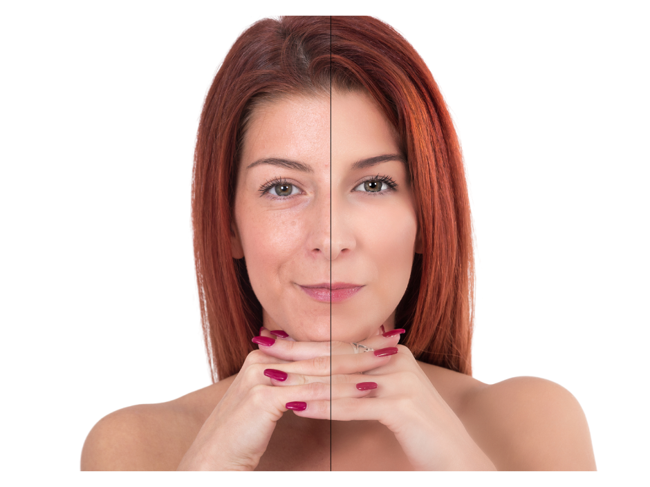 O Que São Bioestimuladores Corporais?