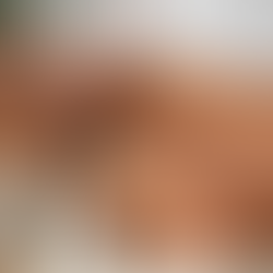 Anvisa alerta para risco de pancreatite em canetas emagrecedoras