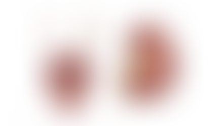 Você sabia que no mundo, em média, 1 em cada 10 pessoas terá um cálculo renal ao longo da vida?