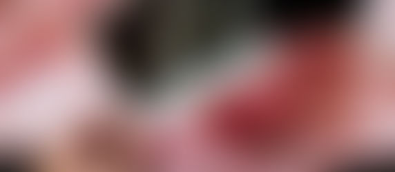 В Казахстане растёт количество беременных с тяжелыми соматическими патологиями, которые впервые диагностированы во время беременности