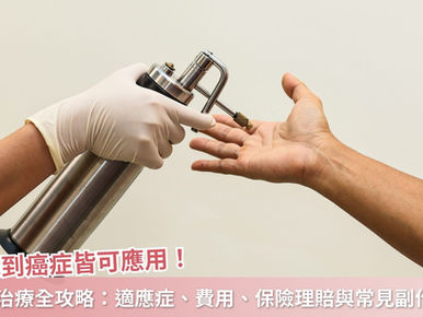 菜花到癌症皆可應用!冷凍治療全攻略:適應症、費用、保險理賠與常見副作用懶人包