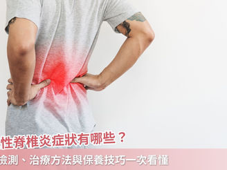 僵直性脊椎炎症狀有哪些?自我檢測、治療方法與保養技巧一次看懂