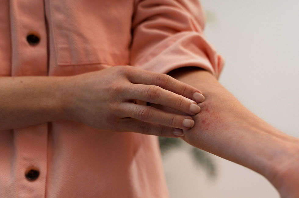 Is this Psoriasis? ways to get checked