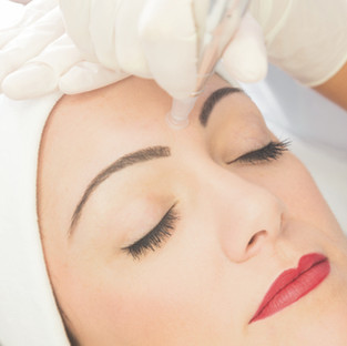 Meso Skin Rejuvenation for fine lines and wrinkles