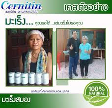 ดาวน์โหลด (7)