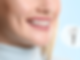 What Questions Should I Ask My Dentist About Implants