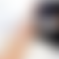 Alternatives to Botox for Anti-Aging Techniques