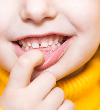 managing early tooth loss in children in South Jersey