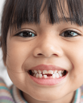 space maintainers for kids in South Jersey