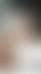How Long Does Microblading Last on Average?