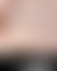 Reveal Radiance Like Never Before: Introducing the Secret PRO Laser at Plastic Surgery Plus