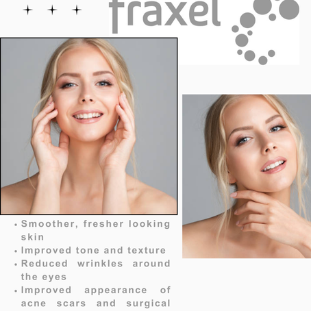 Reveal Radiant Skin with Fraxel® Laser Treatment: What You Need to Know