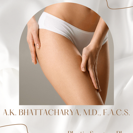 Rediscover Confidence in Every Step: Why a Thigh Lift Could Be Your Next Best Move