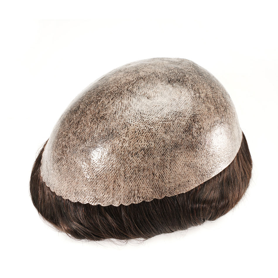 Thumbnail: SHD - Ultra-Thin Capillary Hair System