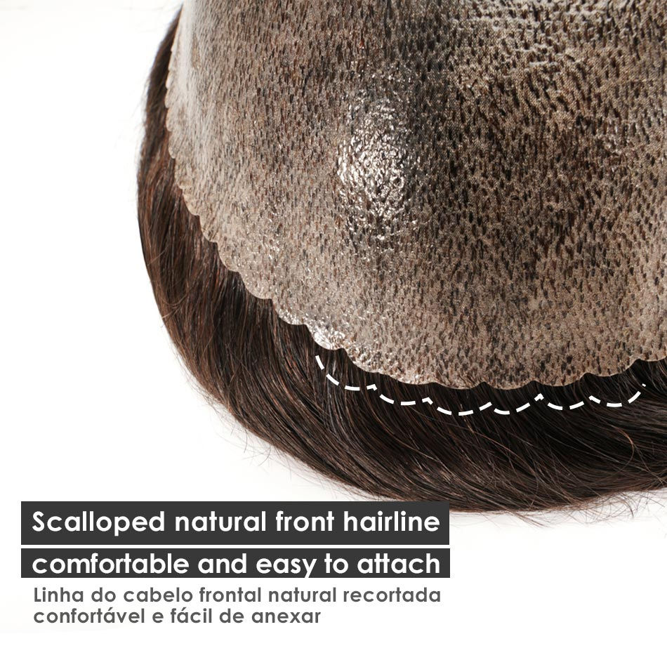 Thumbnail: SHD - Ultra-Thin Capillary Hair System