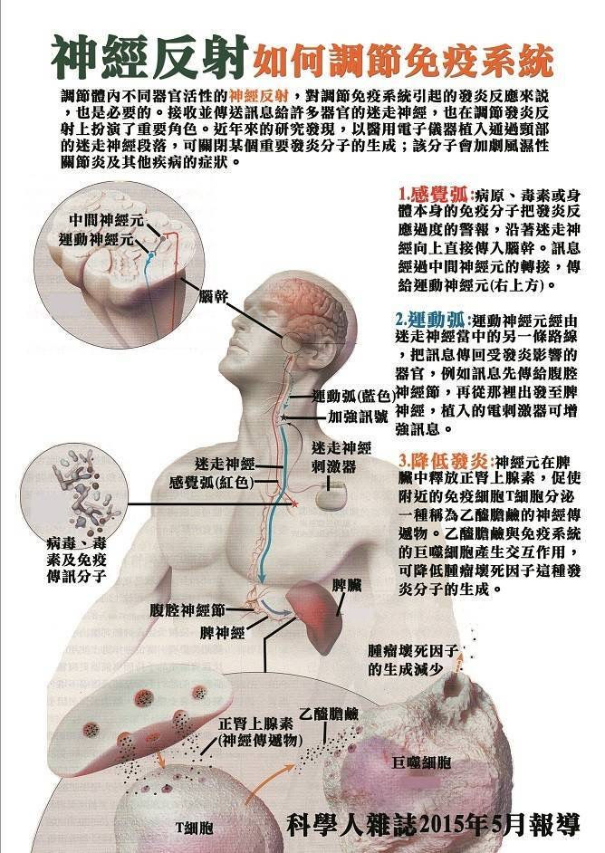 縮圖：PIHARA Static electric therapy apparatus