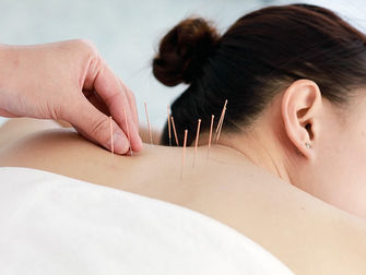 How Acupuncture and Herbal Medicine Address Depression