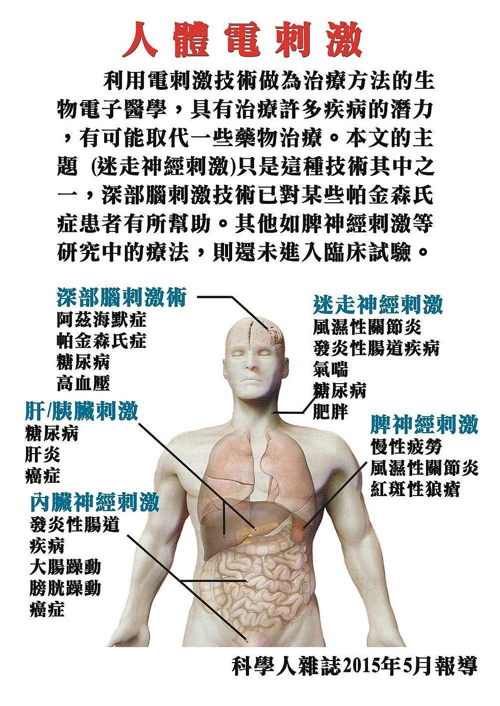縮圖：PIHARA Static electric therapy apparatus