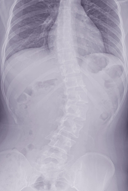 Spine website 2.jpeg