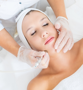 Microdermabrasion - Skintastic Med Spa