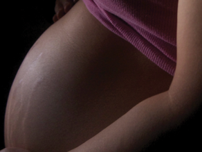 Fertility and Hyperbarics