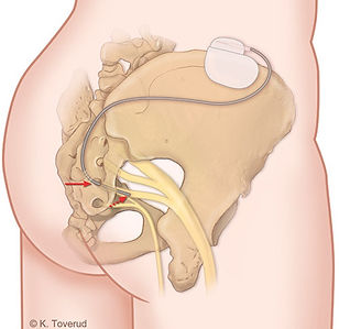 Pelvic3.jpg