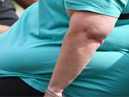 Obesity Related Illness Killed 369 Maltese People In 2019
