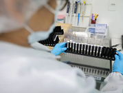 Vacina brasileira contra malária avança para testes em humanos