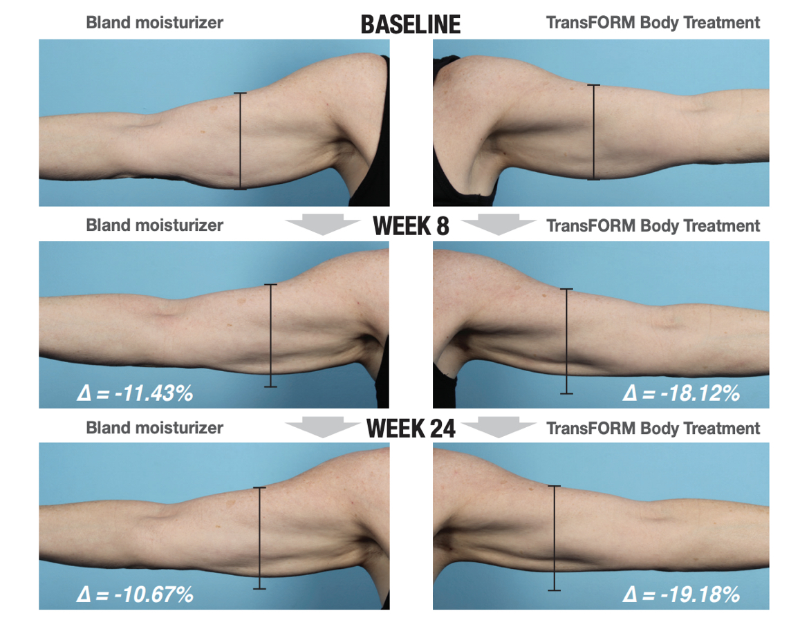 Get SummerReady with the Latest in Body Contouring