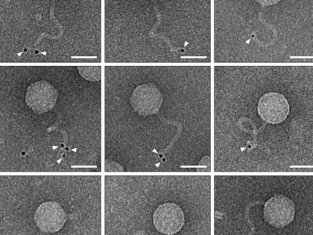 Onderzoekers van het Weizmann Institute of Science vangen een virus bij zijn staart