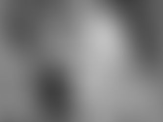 Breaking the Cycle Understanding How Emotional Dysregulation Fuels RSD in Unexpected Ways