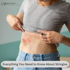Homeopathy for Shingles: Natural Relief and Supportive Measures
