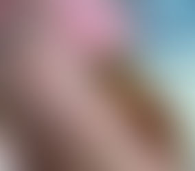 Homeopathy For Measles