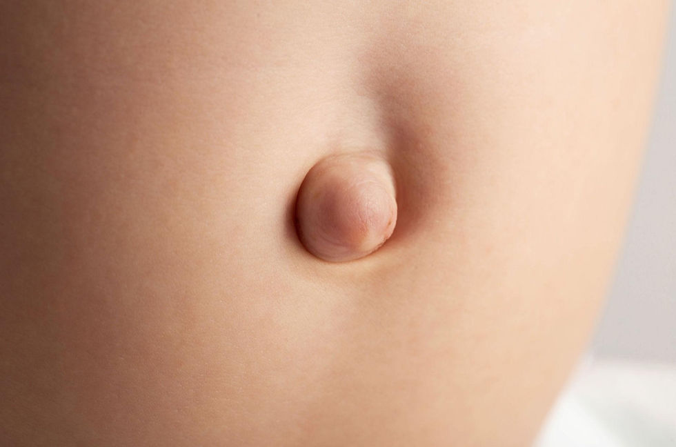 Homeopathy and Umbilical Hernias: A Gentle Perspective on a Structural Problem